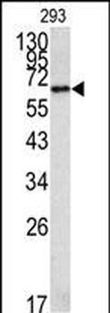 Methionine Aminopeptidase 2 (METAP2) Antibody (C-term)