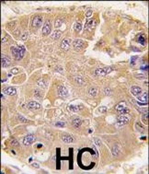 Methionine Aminopeptidase 2 (METAP2) Antibody (C-term)