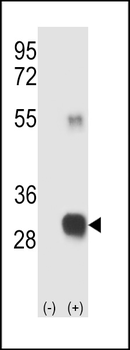 RCE1 Antibody (N-term W57)
