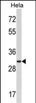 MARCKS Antibody (C-term)