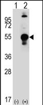 LECT1 Antibody (C-term)