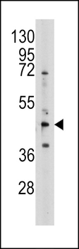 S adenosylhomocysteine hydrolase (ACHY) Antibody (N-term)