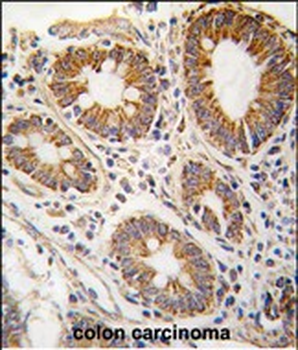 S adenosylhomocysteine hydrolase (ACHY) Antibody (N-term)