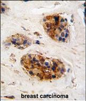 Vimentin Antibody (Center)