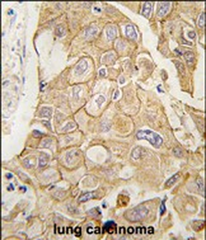 ADCY2 Antibody (C-term)