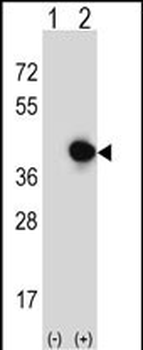 RFC5 Antibody (Center R185)