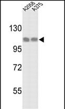 HSPH1 Antibody (C-term)