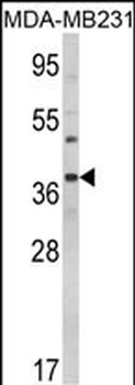 BAG1 Antibody (C-term)