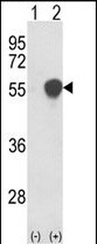PHGDH Antibody (N-term)