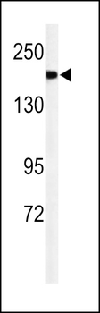 A2ML1 Antibody (N-term)