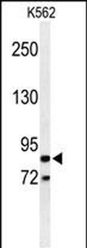 AVIL Antibody (N-term)