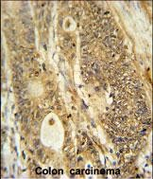 AVIL Antibody (N-term)