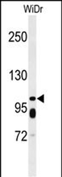 ABCC11 Antibody (N-term)