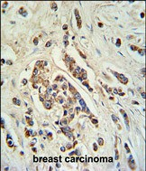 ABCC11 Antibody (N-term)