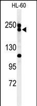 BLM Antibody (C-term)