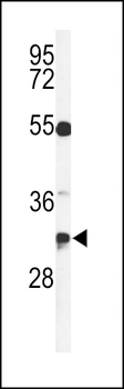TSPAN7 Antibody (Center)
