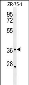 MIIP Antibody (C-term)