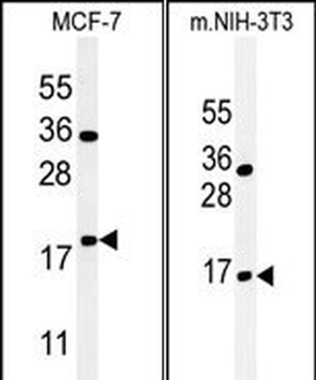 BTG1 Antibody (Center)