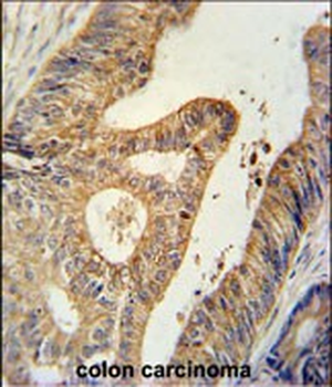 BTG1 Antibody (Center)