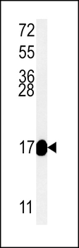 RT33 Antibody (C-term)