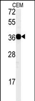 CD300LB Antibody (N-term)