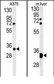 FYTD1 Antibody (N-term)