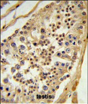 L1TD1 Antibody (C-term)