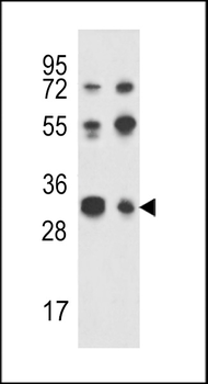 RPA43 Antibody (C-term)
