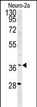 SNRNP40 Antibody (Center)