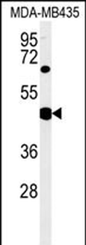 SH2D2A Antibody (Center)