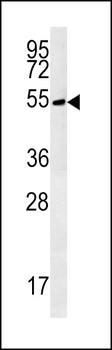TRMT11 Antibody (C-term)