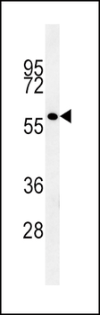 GP6 Antibody (C-term)