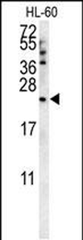 COQ7 Antibody (C-term)