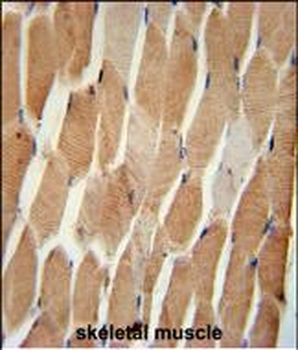 COQ7 Antibody (C-term)