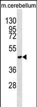 DDX47 Antibody (C-term)