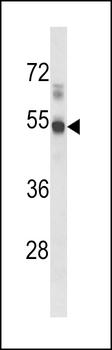 EDG1 Antibody (N-term)