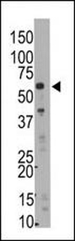 SMYD5 (RAI15) Antibody (C-term)