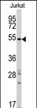 SMYD5 (RAI15) Antibody (C-term)
