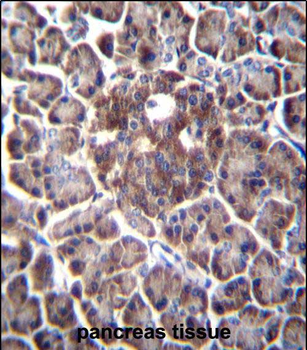 DDIT4 Antibody (C-term)