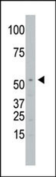 SPPL2a Antibody (N-term)