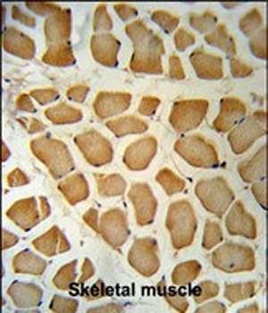 PSA Antibody (C-term)
