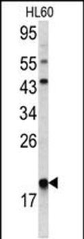 ARPC3 Antibody (C-term)