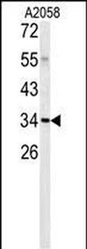 C1QTNF1 Antibody (N-term)