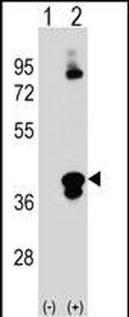 C1QTNF1 Antibody (N-term)