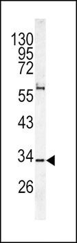 CACNG5 Antibody (C-term)