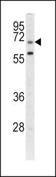 GARP Antibody (Center)