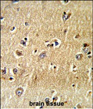SCFD1 Antibody (C-term)