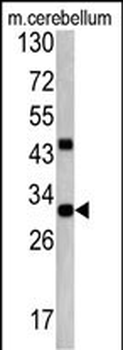 ZWINT Antibody (Center)