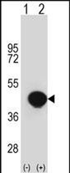 BGN Antibody (Center)
