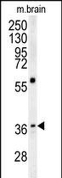 MAPRE1 Antibody (N-term)